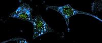 melanoma cells, photo from National Cancer Institute